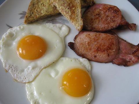 Lorelei Bed & Breakfast - Kingaroy Accommodation 2